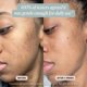 thumbnail image 4 of Suero Facial ROSE Ingleton MD FutureBright 30 ml Vitamina C, 4 of 9