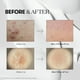 thumbnail image 2 of Sérum VT COSMETICS CICA Reedle Shot 50 para el cuidado de los poros, 50 ml, 2 of 3