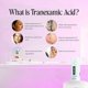 thumbnail image 3 of Suero facial Helloskin 30 ml Ácido tranexámico y Vitamina C, 3 of 3