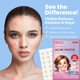 thumbnail image 2 of MEDca Hydrocolloid Acne Patch – 112 Ct, Spot Treatment, 2 Sizes, 2 of 9