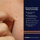 thumbnail image 3 of Parches PanOxyl PM 40 unidades, 3 of 3