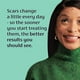 thumbnail image 2 of Gel para cicatrices Mederma Advanced 50 g x2, 2 of 3