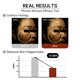 thumbnail image 4 of Suero facial mito:ON Rejuvenecimiento celular 30 ml anti‑edad, 4 of 9
