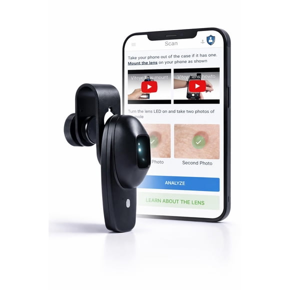 Accesorio dermatoscopio para smartphone 4x de aumento con app