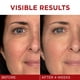 thumbnail image 2 of Crema hidratante L'Oréal Paris Revitalift Triple Power 50 ml, 2 of 3