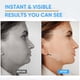 thumbnail image 4 of Cinta invisible para lifting facial, 90 unidades, ultrafina y elástica, con forma de V para disimular arrugas, papada y reafirmar la piel flácida., 4 of 7