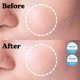 thumbnail image 4 of Mascarilla Facial y de Cuello Jung Beauty Carboxy CO2 4 Unidades, 4 of 9