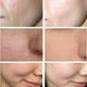 thumbnail image 2 of Facial Essence Liquid Lactobionic Acid Shrink Pores Serum Moisturizing Purify Pore Treatment Beauty Skin Care Whitening Cream, 2 of 3