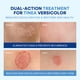 thumbnail image 3 of Kit de tratamiento para tiña versicolor, crema con hierbas, 60 ml y jabón, 120 g, 3 of 7