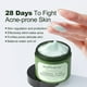 thumbnail image 2 of JoyPretty Herbal Acne Face Cream Body Pimple Treatment Oil Control Moisturizing Facial Creams Skin Care Products Beauty, 2 of 3