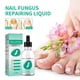 thumbnail image 2 of 30ml nail fungus treatment gel herbal nail polish foot protection skin care oil repair cream foot nail polish repair products, 2 of 3