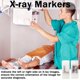 thumbnail image 3 of Marcadores de Rayos X MENURSY L/R 3 cm × 1,3 cm – 100 uds por letra, 3 of 5