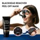 thumbnail image 2 of Mascarilla facial Roseblem 78 g Eliminador de puntos negros con carbón, 2 of 7