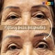 thumbnail image 2 of Eyelid - Lifting Para Párpados S, 2 of 3