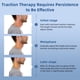 thumbnail image 5 of Dispositivo de tracción cervical, estirador de cuello Holniva, ajustable, 5 of 8