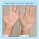 thumbnail image 4 of Crema para aliviar las manos Skinfix reduce el enrojecimiento, 90 ml, piel seca, 4 of 8