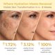 thumbnail image 3 of Crema ABERA Kasumi Glowing Melasma para tratamiento con niacinamida, 3 of 9