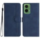 thumbnail image 1 of Funda FOXDOCK para Motorola MOTO G35 -Diseño elegante,Ideal para hombres y mujeres, 1 of 5