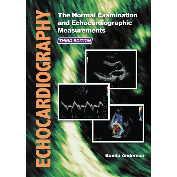 Ecocardiografía: El examen normal y las mediciones ecocardiográficas – Echotext Pty, Limited (Tercera edición)