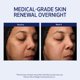 thumbnail image 4 of Reacondicionado Crema de noche Obagi Medical Retinol + PHA Refining 50 ml, 4 of 9