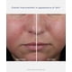thumbnail image 4 of Hidratante facial NEOSTRATA Mandelic Clarifying Hydra Gel, 4 of 9