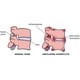 thumbnail image 5 of Libro Medmaster: Rheumatología Hecha Ridículamente Simple, 5 of 5