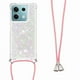 thumbnail image 1 of Funda FOXDOCK para Xiaomi Redmi Note 13 5G con Cuerda Ajustable, Brillo Líquido, Protección Antigolpes y Lente – Ideal para Regalo, 1 of 6