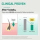 thumbnail image 4 of Tonificador SOME BY MI AHA BHA PHA 30 Days Miracle, 60 ml, paquete de 2, 4 of 5