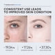 thumbnail image 3 of LAIKOU 7X CERAMIDE Facial Serum Rosacea Red Blood Vein Treatment Improve Sensitive Repair Moisturizing Serum Korean Cosmetics, 3 of 3
