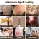 thumbnail image 3 of Crema para el cuidado de heridas LMNOOP Pomada curativa y reparadora de la piel, 3 of 7