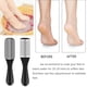 thumbnail image 4 of Kit de pedicura EKOCSIO 36 en 1 con raspador para pies y removedor de piel muerta, 4 of 7