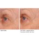 thumbnail image 3 of Suero para Ojos NASSIFMD 15 ml Doble Péptido Reafirmante, 3 of 9