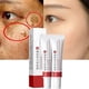 thumbnail image 2 of Crema Fupah Blanqueadora 20g Eliminacian Manchas y Acna, 2 of 3