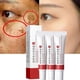 thumbnail image 2 of Crema para Manchas Oscuras 20 g con Colágeno Antiar arrugas Facial, 2 of 3