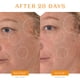 thumbnail image 4 of Sérum Facial Con Vitamina C 20% Antienvejecimiento 5 Ml, 4 of 8