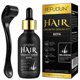thumbnail image 1 of Kit de sérum para el crecimiento del cabello NenmaOkenu 5% de minoxidil para hombres y mujeres, 1 of 3