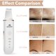 thumbnail image 5 of Espátula exfoliante facial Skin Scrubber MISERWE, color blanco, 5 of 9