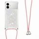 thumbnail image 3 of Funda FOXDOCK para Samsung Galaxy S26 Edge con Cuerda Ajustable, Brillo Líquido, Protección Antigolpes y Lente – Ideal para Regalo, 3 of 6