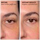thumbnail image 3 of Crema Correctora para Ojos Dermelect 15 ml, 3 of 9