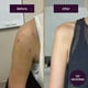 thumbnail image 3 of Gel para cicatrices Mederma Advanced 50 g x2, 3 of 3