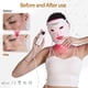 thumbnail image 4 of Mascarilla Led Red Light Therapy 850nm Portátil, 4 of 6