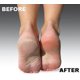 thumbnail image 4 of Rodillos de recarga Emjoi Micro-Pedi extra gruesos (paquete de 4), 4 of 5