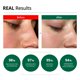 thumbnail image 5 of Crema de recuperación hidratante Dr.G Red Blemish Clear 70 ml, 5 of 9