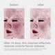 thumbnail image 3 of Limpiador Facial EltaMD Skin Recovery 30 ml Mujer, 3 of 3