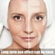 thumbnail image 3 of Rejuvenate Your Skin Instantly with Reusable Face Wrinkle Smoothing Patches!, 3 of 4