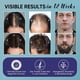 thumbnail image 3 of Spray Minoxidil 5% Olivita Crecimiento Capilar 60 ml Unisex, 3 of 3