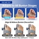 thumbnail image 3 of Corrector de juanetes HEMEXS 3D ajustable para mujeres y hombres, 3 of 9