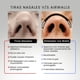 thumbnail image 3 of Dilatador Nasal, 3 of 3