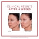thumbnail image 5 of Suero Consult Beaute Volumagen 50 ml Dúo Antienvejecimiento, 5 of 9