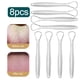 thumbnail image 1 of 8-1pc Tongue Scraper Cleaner For Adult Professional Eliminate Bad Breath Stainless Steel Tongue Brush Fresh Breath Cleaning Tool, 1 of 3